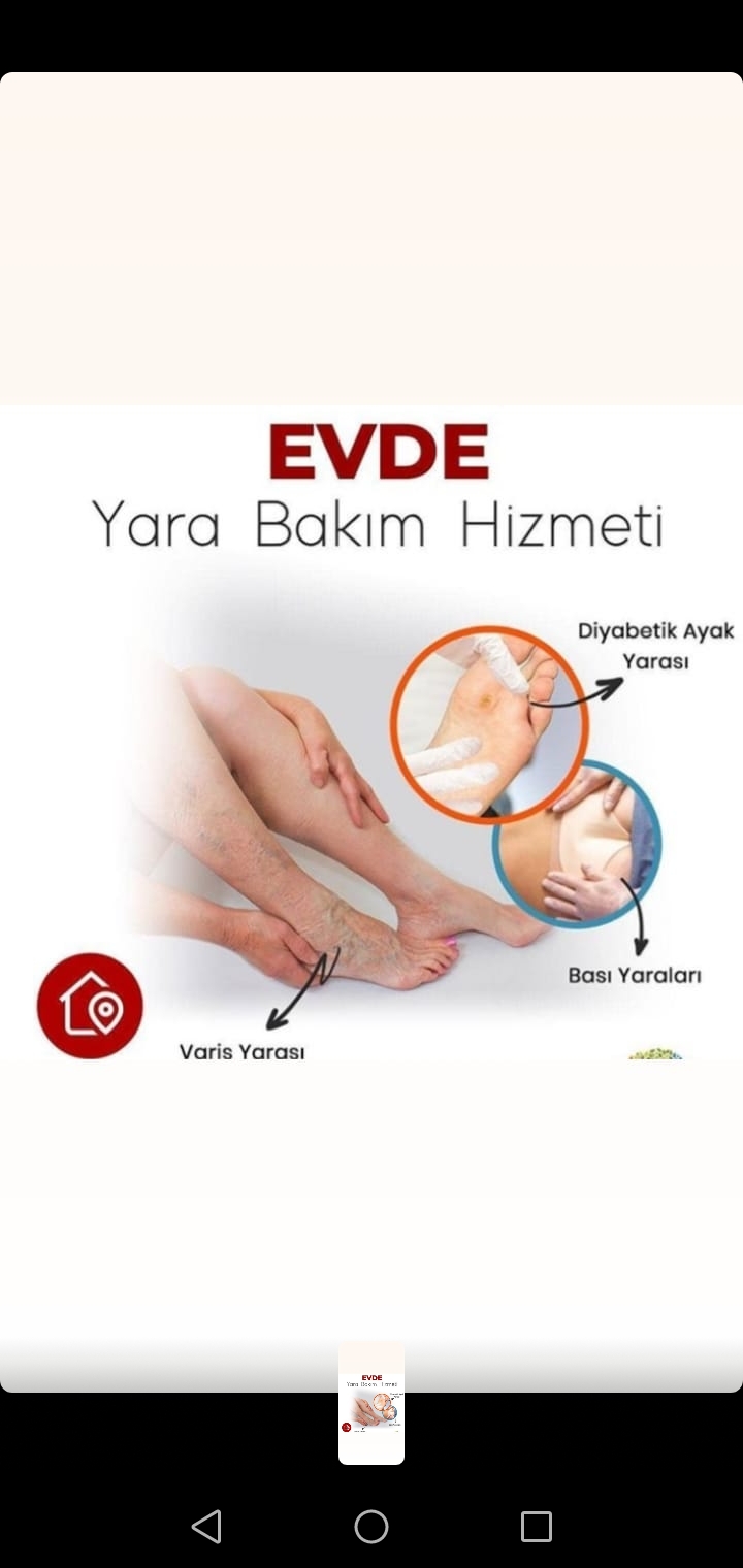 Diyabetik Ayak Yarası Tedavi