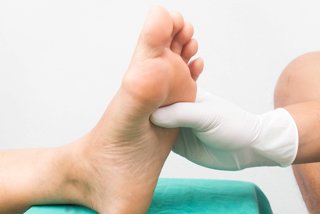 Diabetic Foot Surgical Treatment