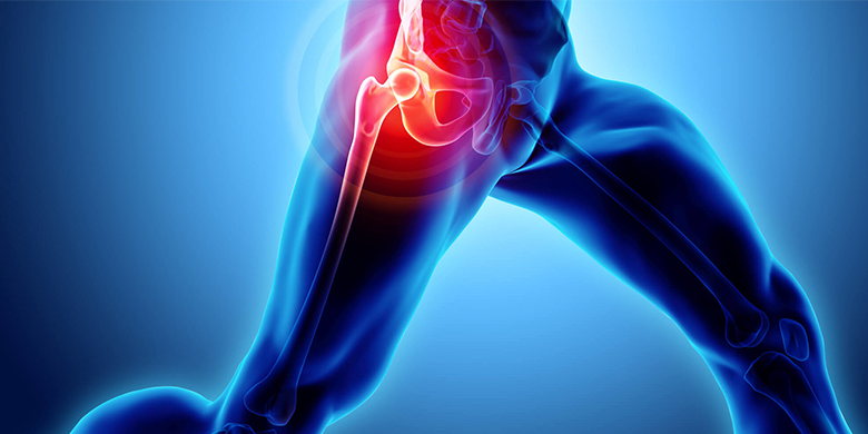 Hip Joint Diseases Surgery