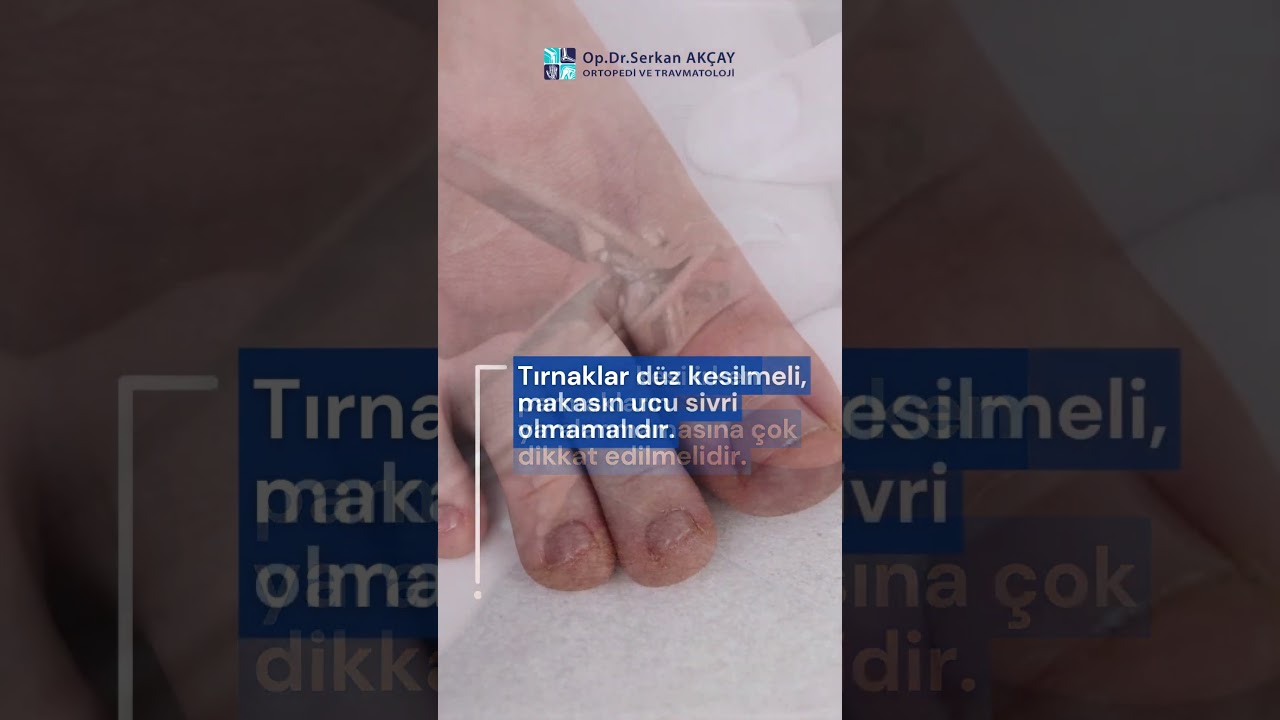 What You Need to Know in Diabetic Foot Treatment | Suggestions for Healthy Feet
